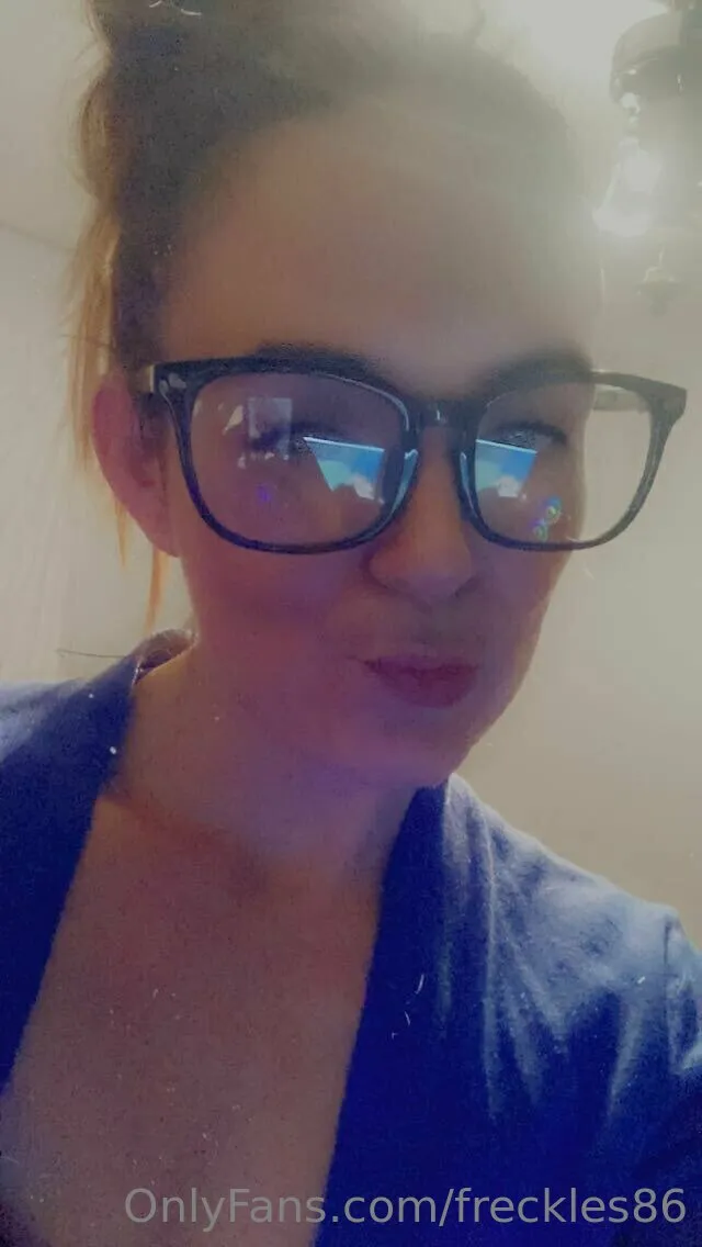 Freckles photo #57