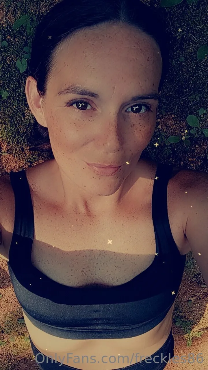 Freckles photo #49