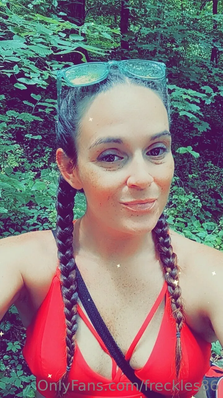 Freckles photo #46