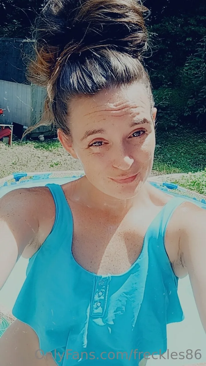 Freckles photo #35