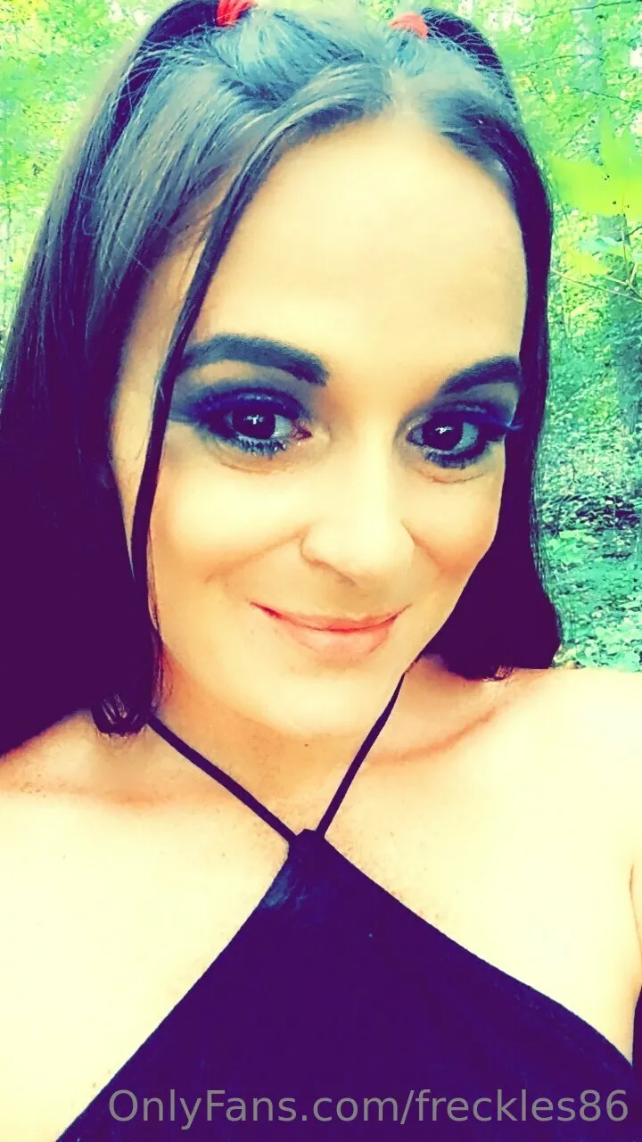 Freckles photo #27