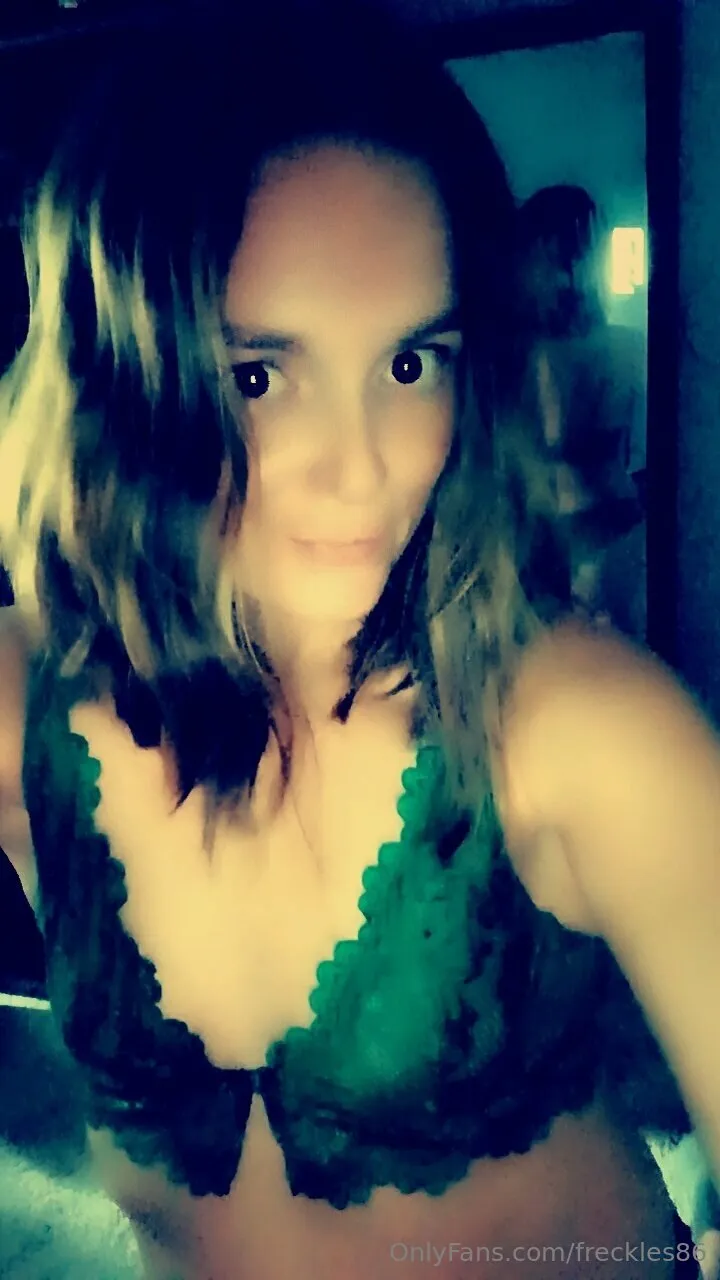 Freckles photo #18