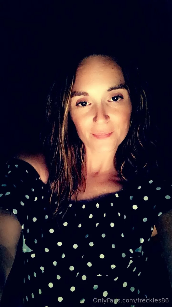 Freckles photo #13