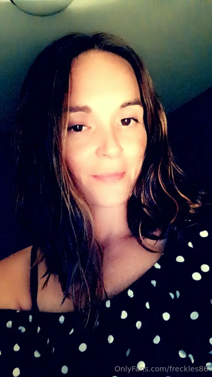 Freckles photo #12