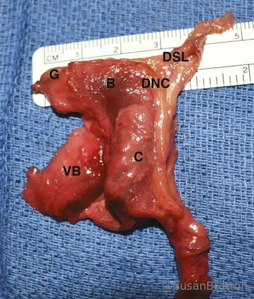 Susan Bratton  💋 Intimacy Advisor photo #62